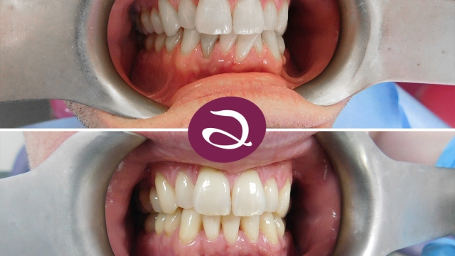 Smile Transformation: Unleashing the Power of Orthodontics