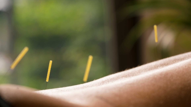 The Art of Balancing Energy: Unveiling the Secrets of Acupuncture