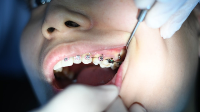 The Benefits of Mindfulness in Dental Care